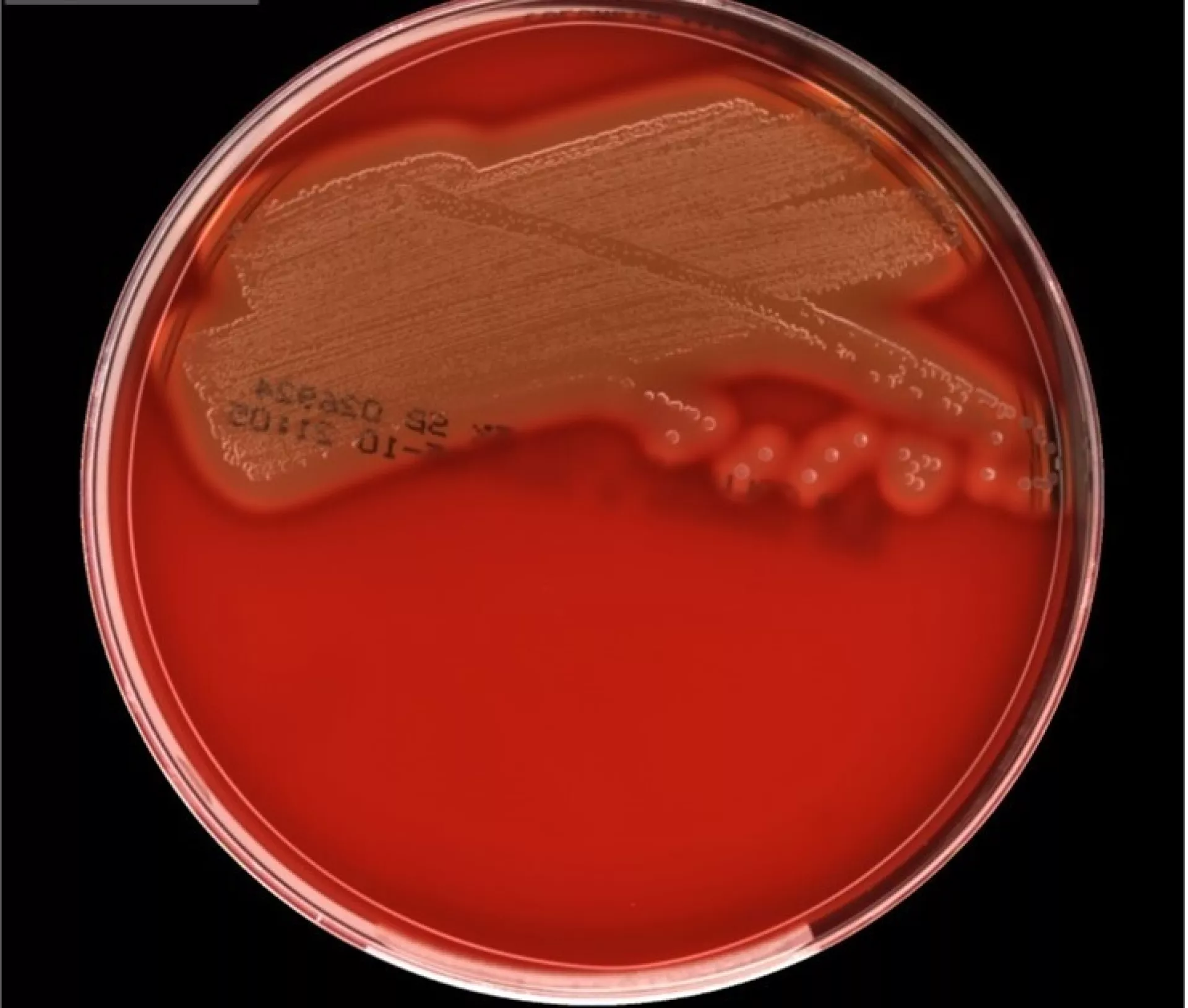 Streptokok op voedingsbodem
